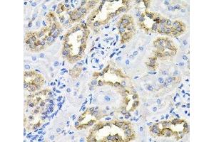 Immunohistochemistry of paraffin-embedded Rat kidney using CDCA8 Polyclonal Antibody at dilution of 1:100 (40x lens). (CDCA8 anticorps)