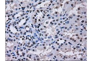 Image no. 5 for anti-Replication Protein A2, 32kDa (RPA2) antibody (ABIN1500735) (RPA2 anticorps)