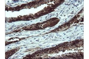 Image no. 4 for anti-Cytidine Monophosphate (UMP-CMP) Kinase 1, Cytosolic (CMPK1) antibody (ABIN1497542)