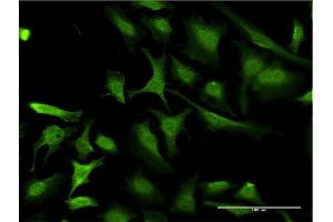 Immunofluorescence of monoclonal antibody to RING1 on HeLa cell.