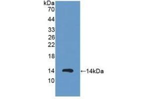Detection of Recombinant PKIa, Human using Polyclonal Antibody to Protein Kinase Inhibitor Alpha (PKIa) (PKIA anticorps  (AA 13-71))