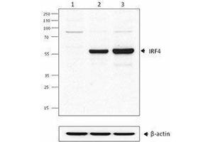 Western Blotting (WB) image for anti-Interferon Regulatory Factor 4 (IRF4) antibody (ABIN2665206) (IRF4 anticorps)