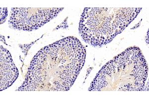 Detection of PTPN5 in Mouse Testis Tissue using Polyclonal Antibody to Protein Tyrosine Phosphatase, Non Receptor Type 5 (PTPN5)