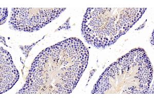 Detection of PTPN5 in Mouse Testis Tissue using Polyclonal Antibody to Protein Tyrosine Phosphatase, Non Receptor Type 5 (PTPN5) (PTPN5 anticorps  (AA 270-533))