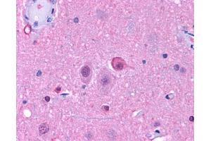 Anti-NPY5R antibody IHC of human brain, neurons and glia. (NPY5R anticorps  (Cytoplasmic Domain))