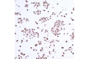 anti-Ubiquitin Specific Peptidase 7 (Herpes Virus-Associated) (USP7) (AA 1-50) antibody