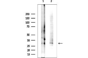 anti-Coiled-Coil Domain Containing 3 (CCDC3) antibody