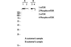 Western Blot (WB) analysis of lysis using Phospho-mTOR (S2448) antibody.