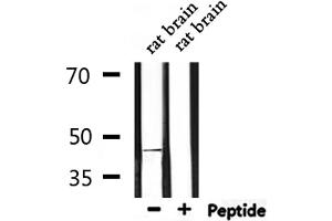 Western blot analysis of extracts from rat brain, using Beta Arrestin 2 Antibody.