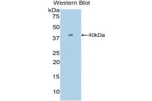 Western Blotting (WB) image for anti-Single Immunoglobulin and Toll-Interleukin 1 Receptor (TIR) Domain (SIGIRR) (AA 1-117) antibody (ABIN1860550)