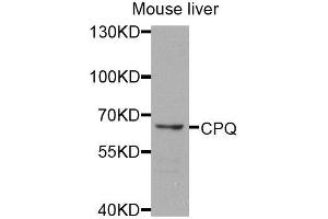 Western blot analysis of extracts of mouse liver, using CPQ antibody (ABIN5974910) at 1/1000 dilution.