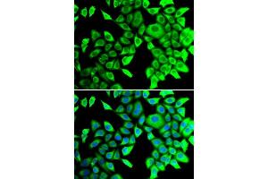 Immunofluorescence analysis of  cells using THADA antibody (ABIN6133115, ABIN6149103, ABIN6149104 and ABIN6222943). (THADA anticorps  (AA 1684-1953))