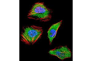 Fluorescent confocal image of Hela cell stained with SMAD4 Antibody .