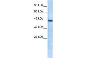 Western Blotting (WB) image for anti-CHRNA7 (Cholinergic Receptor, Nicotinic, alpha 7, Exons 5-10) and FAM7A (Family with Sequence Similarity 7A, Exons A-E) Fusion (CHRFAM7A) antibody (ABIN2461141) (CHRFAM7A anticorps)