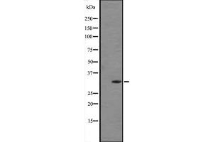 Western blot analysis of FGF5 expression in Human placenta tissue lysate (in RIPA buffer) ;,The lane on the left is treated with the antigen-specific peptide. (FGF5 anticorps  (C-Term))