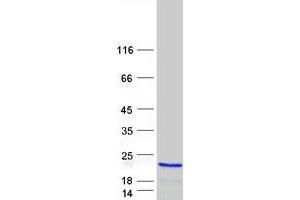 Validation with Western Blot