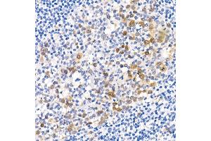 Immunohistochemistry of paraffin-embedded human placenta using Phospho--S473 Rabbit mAb (ABIN6135179, ABIN6135970, ABIN6135971 and ABIN7101880) at dilution of 1:100 (40x lens). (AKT1 anticorps  (pSer473))