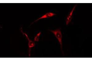 ABIN6274679 staining HT29 cells by IF/ICC. (CIDEB anticorps  (Internal Region))