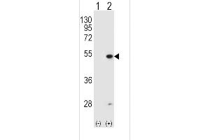 Western blot analysis of FDFT1 (arrow) using rabbit polyclonal FDFT1 Antibody (E11) (ABIN389051 and ABIN2839260). (FDFT1 anticorps  (N-Term))