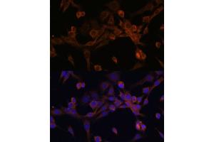 Immunofluorescence analysis of NIH/3T3 cells using EIF2B2 antibody (ABIN6132131, ABIN6140037, ABIN6140038 and ABIN6222805) at dilution of 1:100.