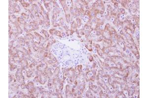 IHC-P Image ANKRD45 antibody detects ANKRD45 protein at cytosol on human normal liver by immunohistochemical analysis. (ANKRD45 anticorps)