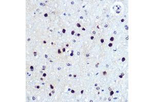 Immunohistochemistry of paraffin-embedded rat brain using HES1 Rabbit mAb (ABIN7267624) at dilution of 1:100 (40x lens).