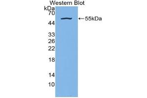 Western blot analysis of the recombinant protein. (Kallikrein 7 anticorps  (AA 24-255))