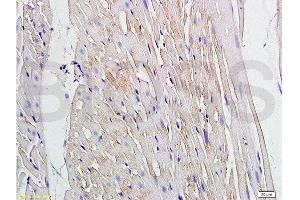 Formalin-fixed and paraffin embedded rat heart labeled with Anti Connexin-37/GJA4 Polyclonal Antibody, Unconjugated  at 1:200 followed by conjugation to the secondary antibody and DAB staining