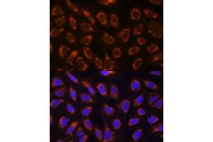 Immunofluorescence analysis of U-2 OS cells using GANAB antibody  at dilution of 1:100.