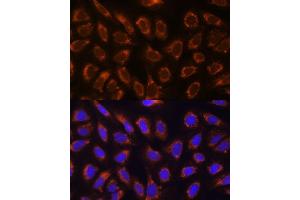 Immunofluorescence analysis of U-2 OS cells using GANAB antibody  at dilution of 1:100. (GANAB anticorps  (AA 1-260))