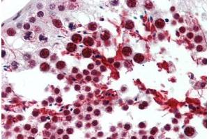 anti-Cyclin E1 (CCNE1) (C-Term) antibody