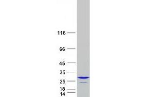 ADP-Ribosylation Factor-Like 3 (ARL3) protein (Myc-DYKDDDDK Tag)