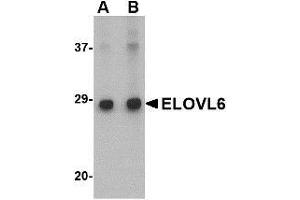 Western blot analysis of ELOVL6 in Human brain tissue lysate with ELOVL6 antibody at (A) 1 and (B) 2 μg/ml.