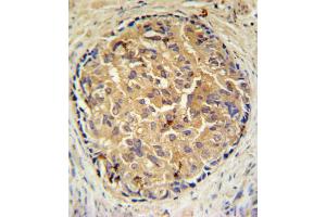 Immunohistochemistry (IHC) image for anti-Steroid 5 alpha-Reductase 3 (SRD5A3) antibody (ABIN3002292) (SRD5A3 anticorps)