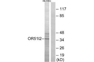 Western blot analysis of extracts from HUVEC cells, using OR51I2 antibody. (OR51I2 anticorps  (Internal Region))