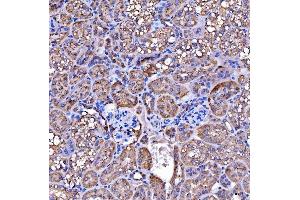 IHC analysis of SUCLG2 using anti-SUCLG2 antibody (ABIN7601694). (SUCLG2 anticorps  (AA 42-424))