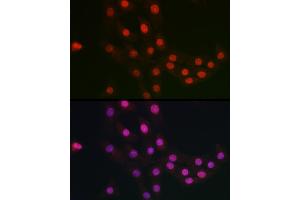 Immunofluorescence analysis of NIH/3T3 cells using FANCC antibody (ABIN3022593, ABIN3022594, ABIN3022595 and ABIN6218931) at dilution of 1:100.