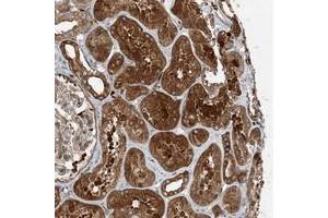 Immunohistochemical staining of human kidney with SNX2 polyclonal antibody  shows strong cytoplasmic and extracellular positivity in tubular cells at 1:500-1:1000 dilution.