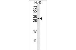 EMX2 Antibody (Center) (ABIN651733 and ABIN2840380) western blot analysis in HL-60 cell line lysates (15 μg/lane). (EMX2 anticorps  (AA 111-138))