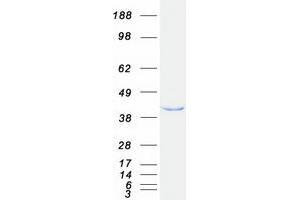 Validation with Western Blot
