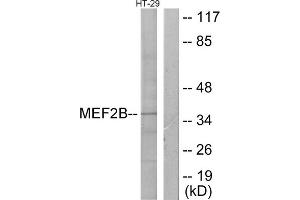 Western blot analysis of extracts from HT-29 cells, using MEF2B antibody. (MEF2B anticorps  (Internal Region))
