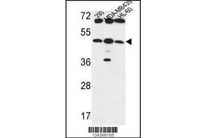 Western blot analysis in 293,MDA-MB435,HL-60 cell line lysates (35ug/lane). (B3GNT5 anticorps  (AA 118-145))