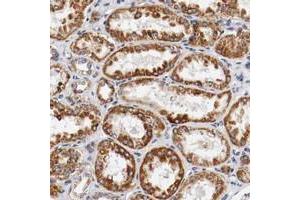 Immunohistochemical staining of human kidney with KIF5A polyclonal antibody  shows strong cytoplasmic positivity in tubular cells. (KIF5A anticorps)