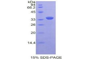 SDS-PAGE analysis of Rat PRDM1 Protein. (PRDM1 Protéine)