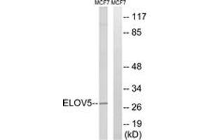 Western blot analysis of extracts from MCF-7 cells, using ELOVL5 Antibody. (ELOVL5 anticorps  (AA 250-299))