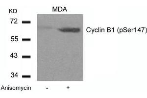 Western blot analysis of extracts from MDA cells untreated or treated with Anisomycin using Cyclin B1(phospho-Ser147) Antibody. (Cyclin B1 anticorps  (pSer147))
