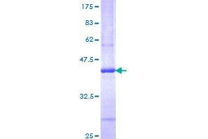 Image no. 1 for Interleukin 13 (IL13) (AA 35-146) protein (GST tag) (ABIN1307687)