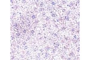 Immunohistochemistry (IHC) image for anti-Plexin Domain Containing 1 (PLXDC1) (C-Term) antibody (ABIN1030730) (PLXDC1 anticorps  (C-Term))