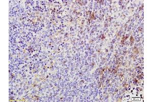 Formalin-fixed and paraffin embedded rat spleen labeled with Rabbit Anti Phospho-TAK1(Thr184/187) Polyclonal Antibody, Unconjugated (ABIN746348) at 1:200 followed by conjugation to the secondary antibody and DAB staining (TR4 anticorps  (pThr184, pThr187))