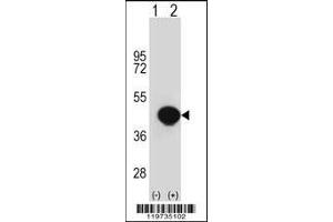 Western blot analysis of BGN using rabbit polyclonal BGN Antibody using 293 cell lysates (2 ug/lane) either nontransfected (Lane 1) or transiently transfected (Lane 2) with the BGN gene. (Biglycan anticorps  (AA 148-176))